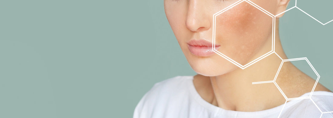 La Verdadera Rutina de Belleza ✨ : Tu Piel Habla de lo que Comes