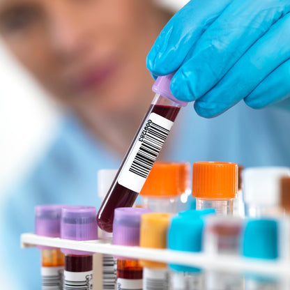 Estudios de sangre para Reto k.eat