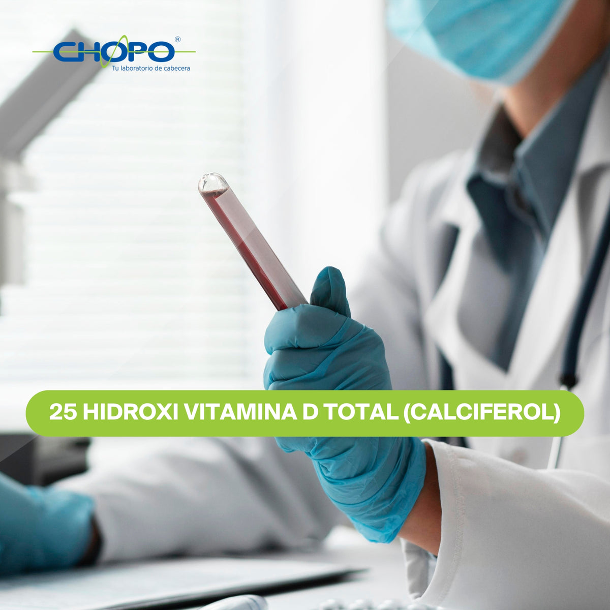 25 Hidroxi Vitamina D Total (Calciferol)