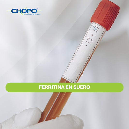 Ferritina en suero