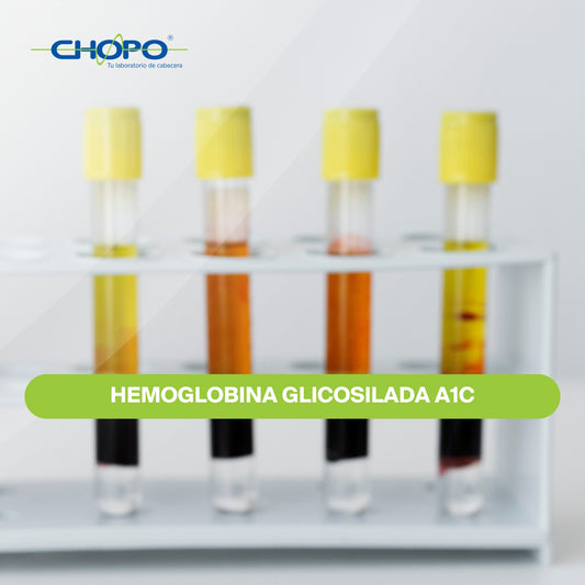 Hemoglobina glicosilada A1C