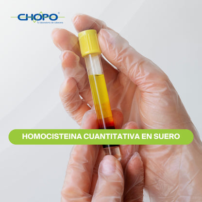 Homocisteina cuantitativa en suero