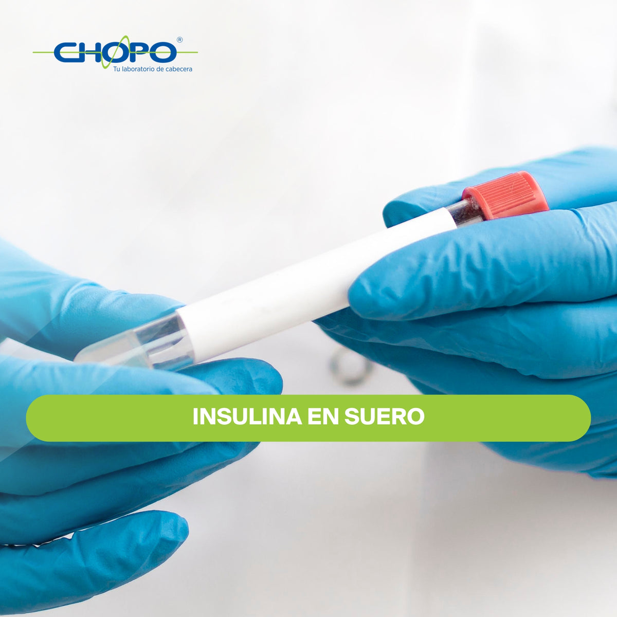 Insulina en suero