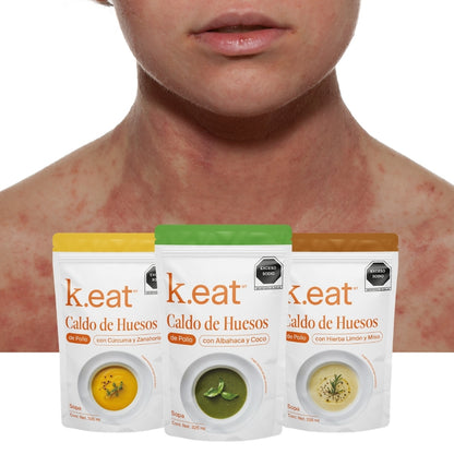 Programa de Caldo de Huesos Dermatitis